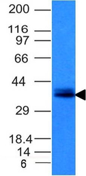 EpCAM antibody [EGP40/1120]