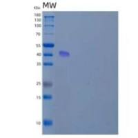 人精氨基琥珀酸合成酶1(ASS1)重组蛋白N-6His