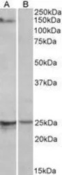 RBM20 antibody