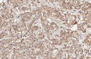 GADD153 antibody [HL2262]