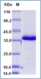 Human IGFBP5 protein, His tag 