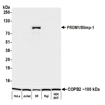 PRDM1/Blimp-1 Antibody 抗体，orb1