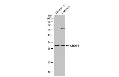 CNOT8 antibody [HL2586]
