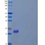人前折叠蛋白亚基4(PFDN4)重组蛋白N-6His