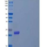 人前折叠蛋白亚基4(PFDN4)重组蛋白N-6His
