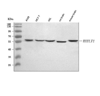 TMEM5/RXYLT1 Antibody 抗体，orb17