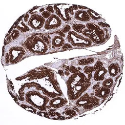 Thyroglobulin antibody [MSVA-1