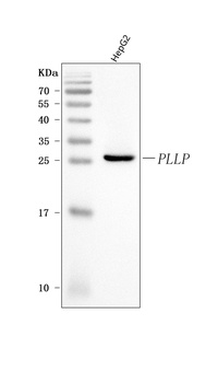 Plasmolipin/PLLP Antibody 抗体，o