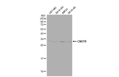 CNOT8 antibody [HL2586]