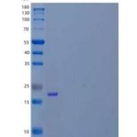 人白介素28B/IFN-lambda 3(IL28B)重组蛋白C-6His