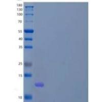 人含BED型锌指蛋白1(ZBED1)重组蛋白C-6His