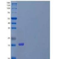 人白介素31(IL31)重组蛋白