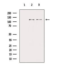 PERK (phospho Thr982) antibody