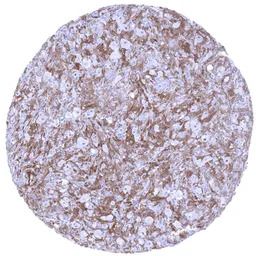 Factor XIIIa antibody [MSVA-81