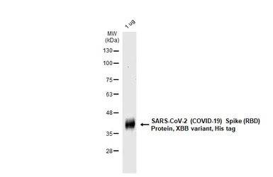 SARS-CoV-2 (COVID-19) Spike RB
