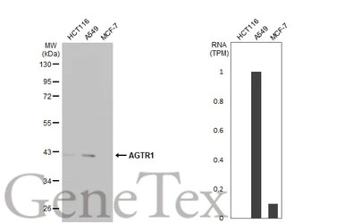 AGTR1 antibody [HL2526]