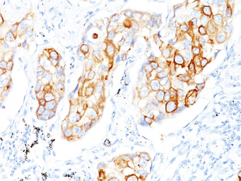 Cytokeratin 7 antibody [OV-TL1