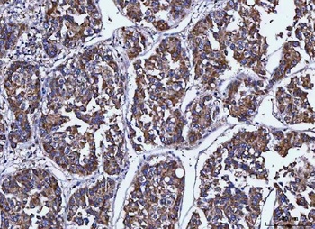 Anti-MCCC1 Antibody 抗体，orb1786