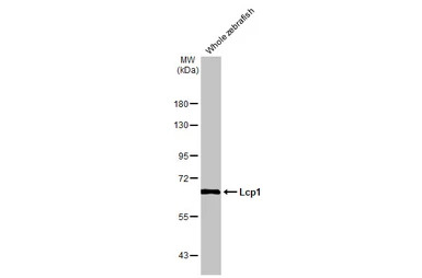 Lcp1 antibody [HL2501]