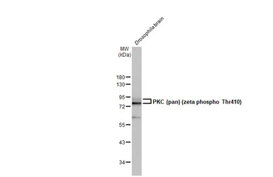 PKC (pan) (zeta phospho Thr410