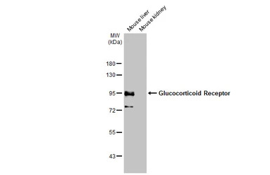 Glucocorticoid Receptor antibo