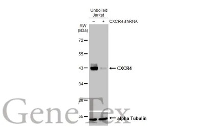 CXCR4 antibody [HL2612]