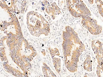 Carbonic Anhydrase XII antibod