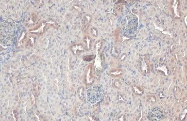 RAB5A antibody [HL1497]