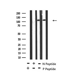 TIE2 (phospho Ser1119) antibod