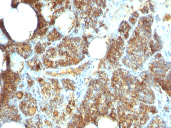 Parathyroid Hormone antibody [
