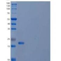 人细胞色素b5/CYB5A重组蛋白N-6His