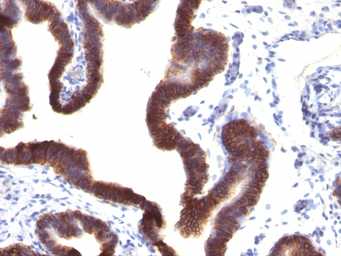 EpCAM antibody [EGP40/1120]