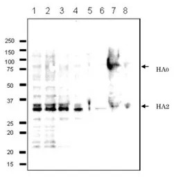 Influenza B virus Hemagglutini