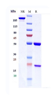 Anti-IGF1R / CD221 Reference A
