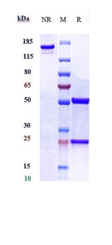 Anti-Amyloid Beta Reference An