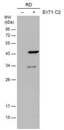 Enterovirus 71 VP1 antibody [G