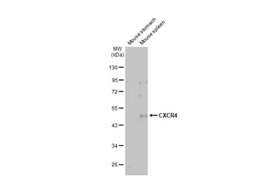 CXCR4 antibody [HL2612]