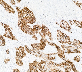 Cytokeratin 14 Antibody 抗体，orb