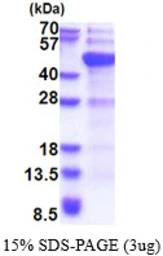 Human DNMT3L protein, His tag