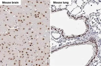 SOX2 antibody [HL1193]