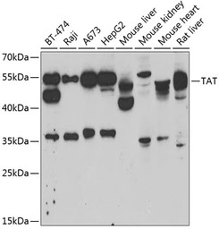 Tyrosine Aminotransferase anti