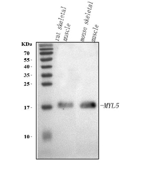 Anti-MYL5 Antibody 抗体，orb17860