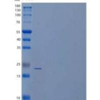 人磷酸泛酸半胱氨酸脱羧酶/DC重组蛋白N-6His