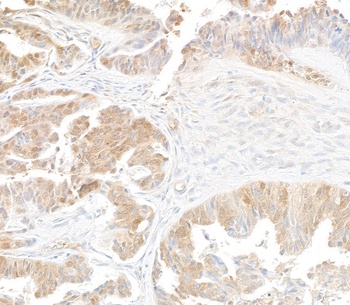 p16INK4a Antibody 抗体，orb180643