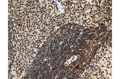 Ki67 (phospho Thr1335) antibod