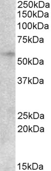 TPD52L2 Antibody 抗体，orb1247626