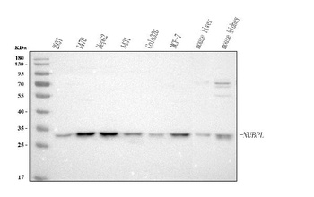 Anti-NUBPL Antibody 抗体，orb1786