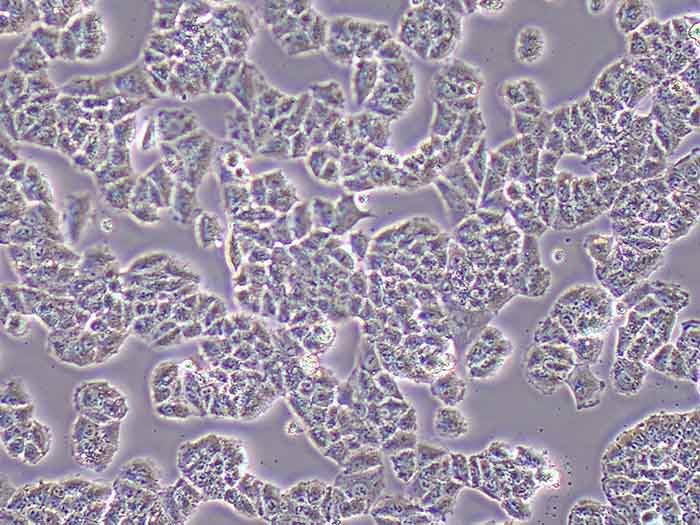 NCI-H460细胞图片