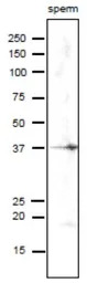 SPESP1 antibody