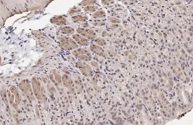 CDK6 antibody [HL2078]